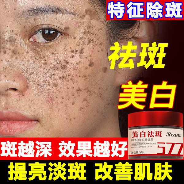 Niacinamide whitening and anti-freckle cream removes melanin, improves dullness, lightens spots and brightens skin tone 377 whitening and anti-freckle cream